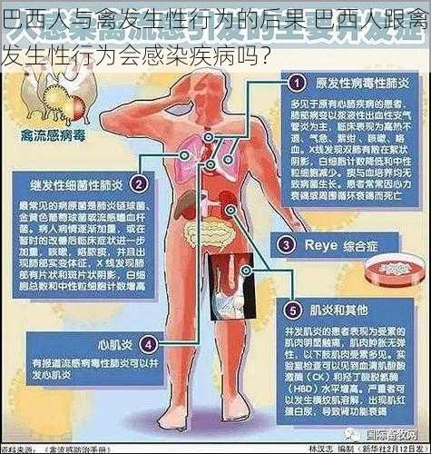 巴西人与禽发生性行为的后果 巴西人跟禽发生性行为会感染疾病吗？