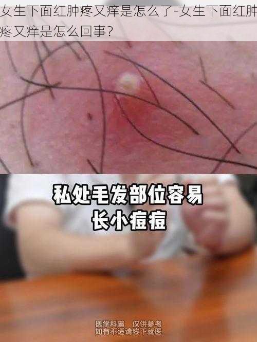 女生下面红肿疼又痒是怎么了-女生下面红肿疼又痒是怎么回事？